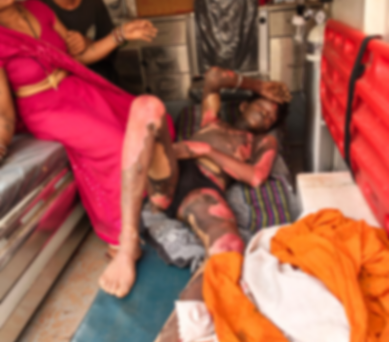 खैरागढ़. 18 वर्षीय युवक ने पेट्रोल डालकर आत्मदाह का किया प्रयास, गंभीर हालत में जिला अस्पताल रेफर