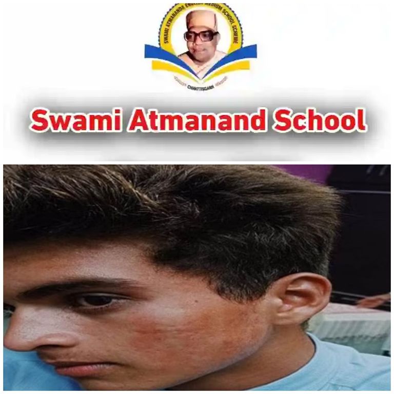 आत्मानंद स्कूल में टीचर ने 9वीं के छात्र को पीटा : परिजनों ने थाने और DEO से की शिकायत, स्टूडेंट सस्पेंड